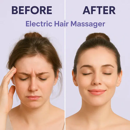 Electric Scalp Massager qf05hs-qj